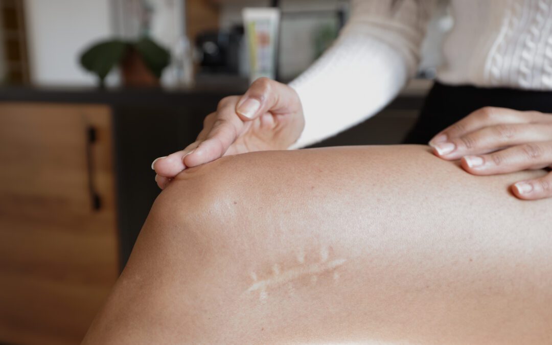 Silicio Orgánico y Articulaciones: Alivie el Dolor y Recupere su Movilidad de Forma Natural